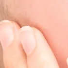 毛穴洗浄